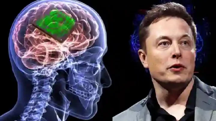 Ilmuwan Cemas Nasib Pasien Elon Musk yang Otaknya Ditanam Chip