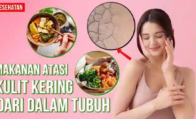 posjos.com — Makanan Ampuh Atasi Kulit Kering. Jenis Makanan Yang Ampuh Atasi Kulit Kering Dari Dalam. Cara Mengatasi Kulit Kering